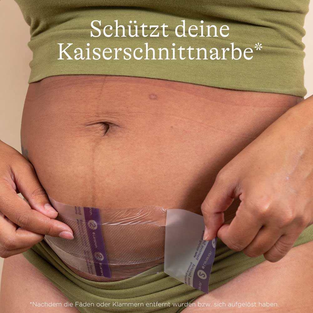 lansinoh-kaiserschnitt-hydrogel-pads-k-hlende-narbenpflege-pads-zur-beruhigenden image 2